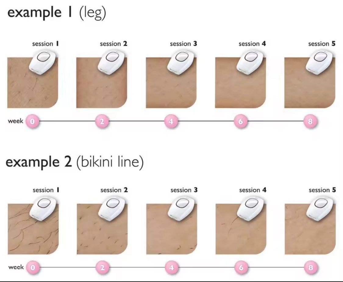 SilkSkin IPL Pulse - Effortless At-Home Hair Removal