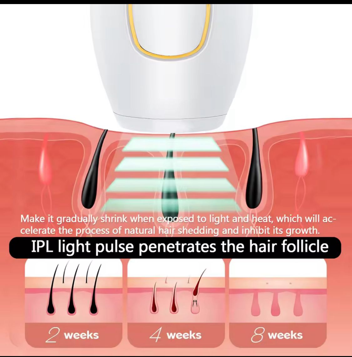 IPL Pulse • Épilateur à Lumière Pulsée