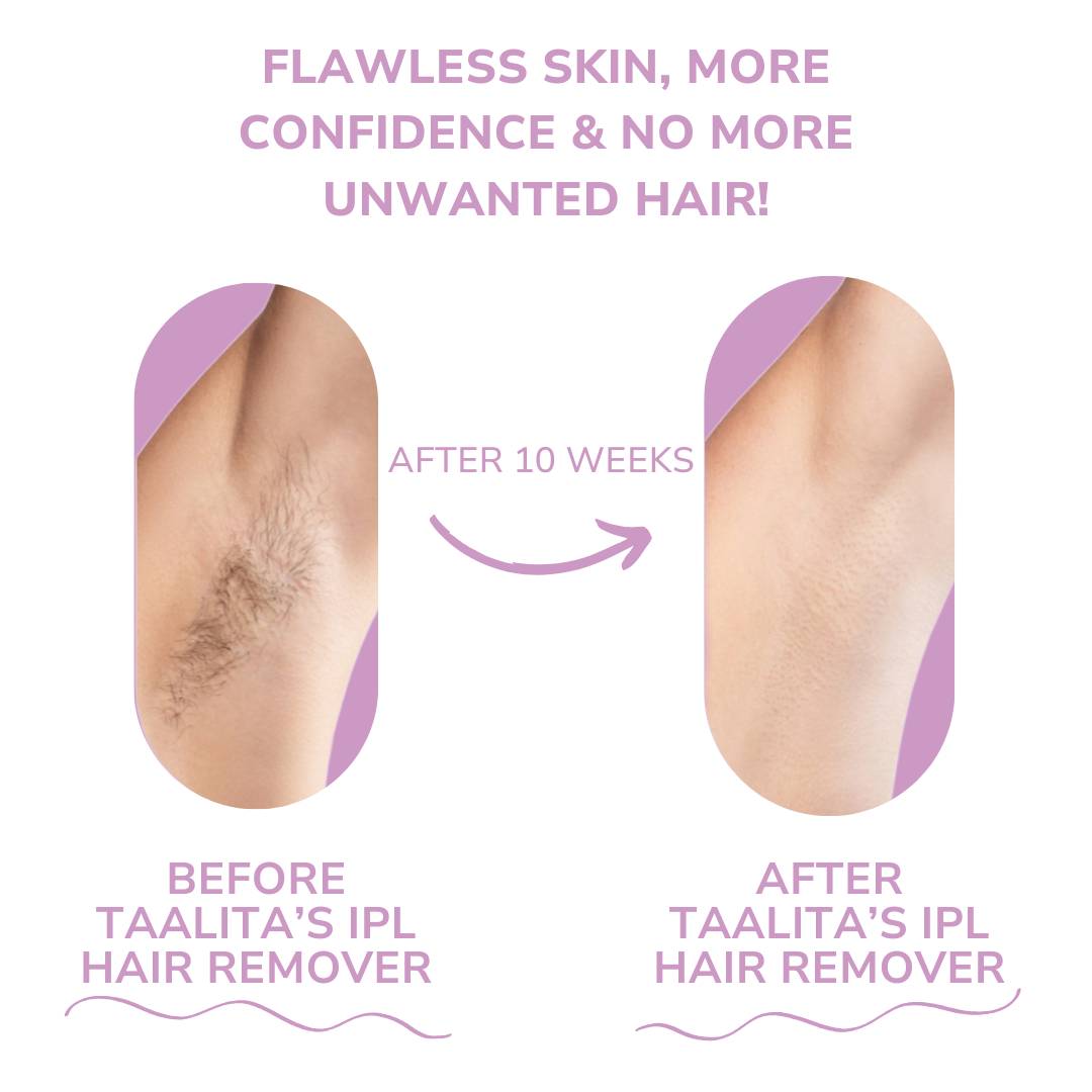 SilkSkin IPL Pulse - Effortless At-Home Hair Removal