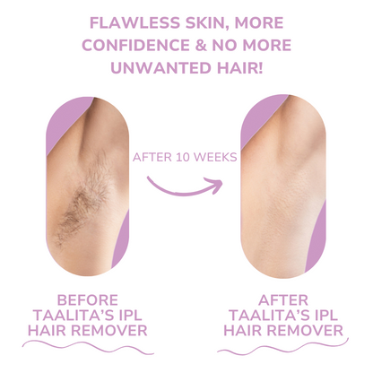 SilkSkin IPL Pulse - Effortless At-Home Hair Removal